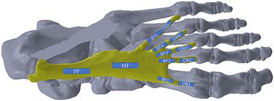 Morphology and Mechanical Properties of Plantar Fascia in Flexible Flatfoot: A Noninvasive In Vivo Study